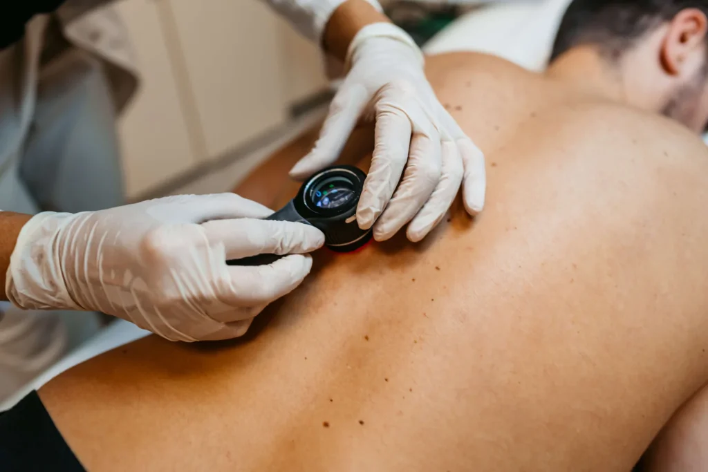 Dr Irena Komljenović vrši dermatoskopiju i pregled mladeža u poliklinici Regena
